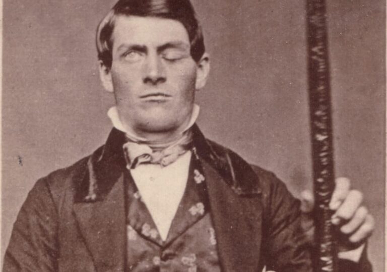 La personalità è nel lobo frontale? Lo strano caso di Phineas Gage